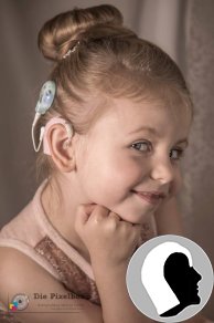 CI Kopf 2018 weiblich Kind